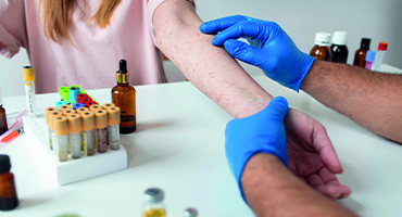 Alerji Testi (Deri Prick Testi) Nedir?